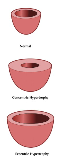 Left ventricle